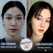 Thẩm Mỹ Viện Quốc Tế 108